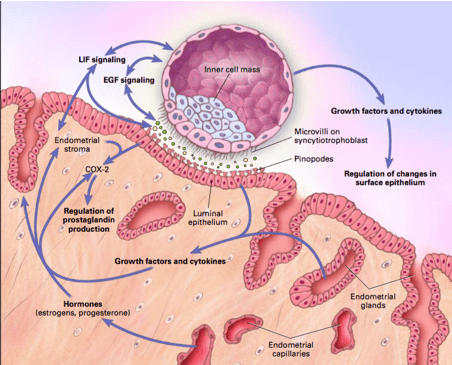 Endometrite e falha de implantação: existe relação?