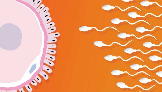 Diagnóstico Genético Pré-Implantacional Embrionário: qual é a necessidade do exame PGD para o tratamento de fertilização?