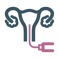Inseminação Artificial